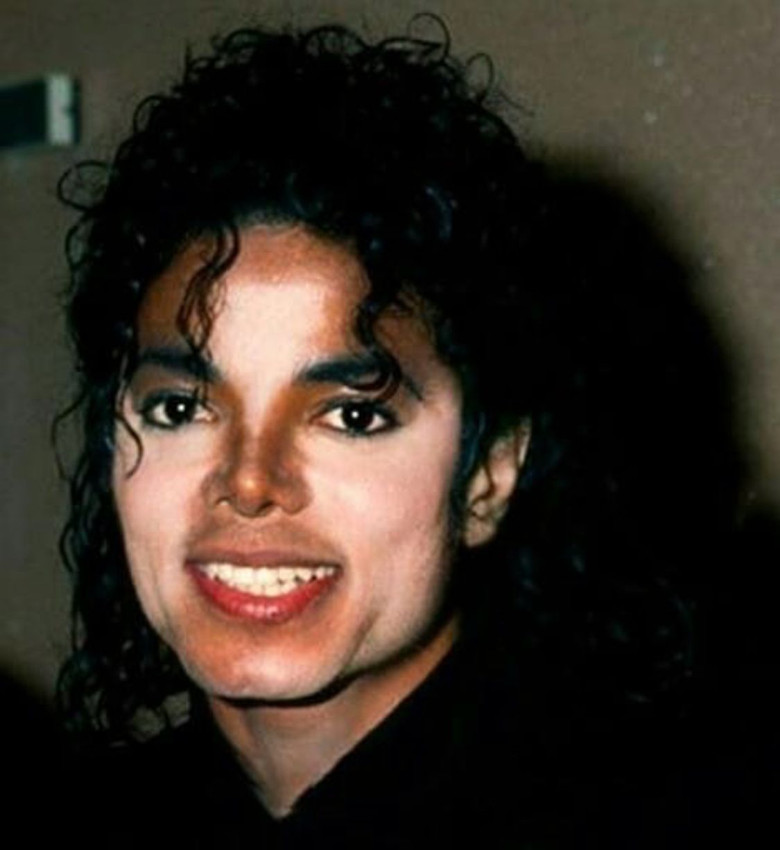 Michael Jackson Bild Vitiligo